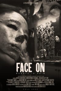 face-on